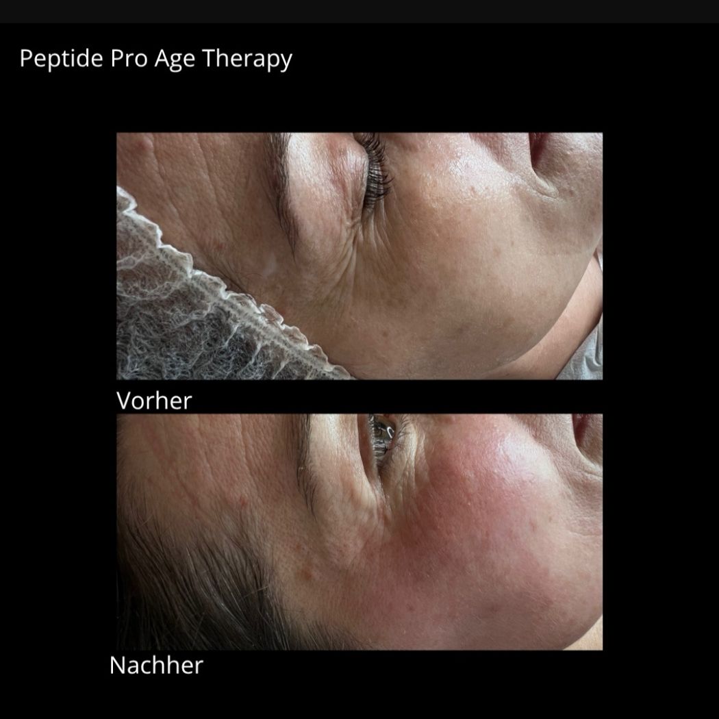 Double Lift Peptide Pro Age Berlin