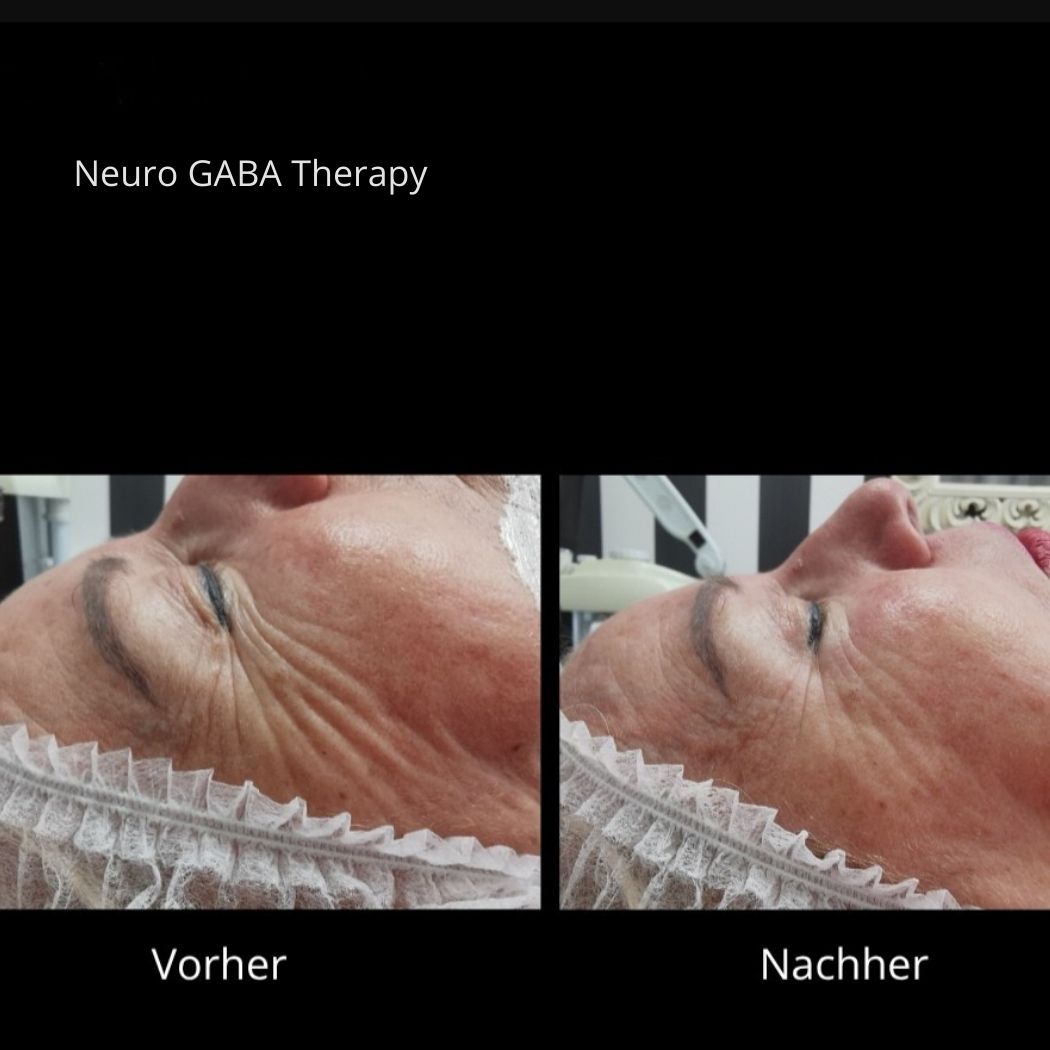 Mirella Beauty Neuro GABA Sofort-Lifting PRE / ANTI AGING