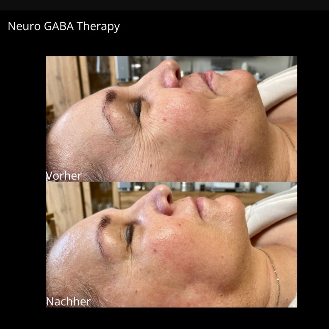 Neuro GABA Sofort-Lifting