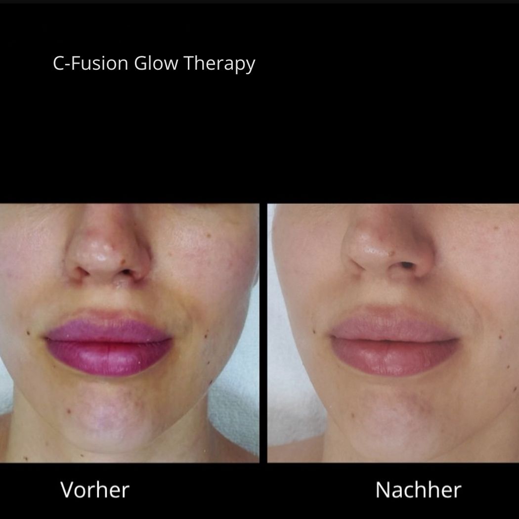 C-Fusion Glow Mirella Beauty PRE / ANTI AGING