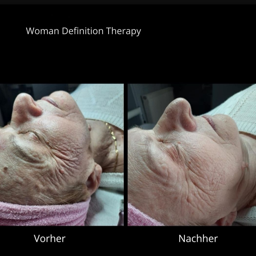 PRE / ANTI AGING Woman Definition