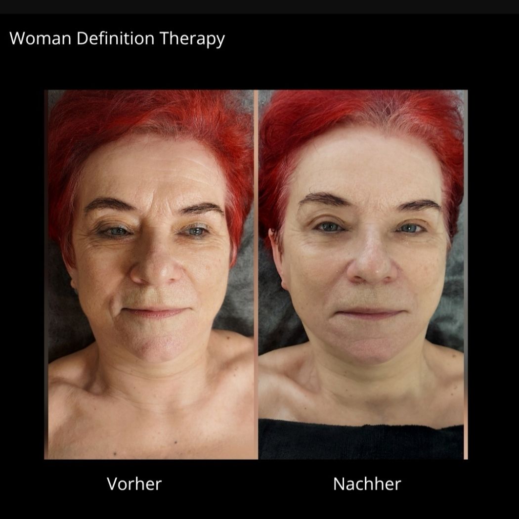 Woman Definition PRE / ANTI AGING