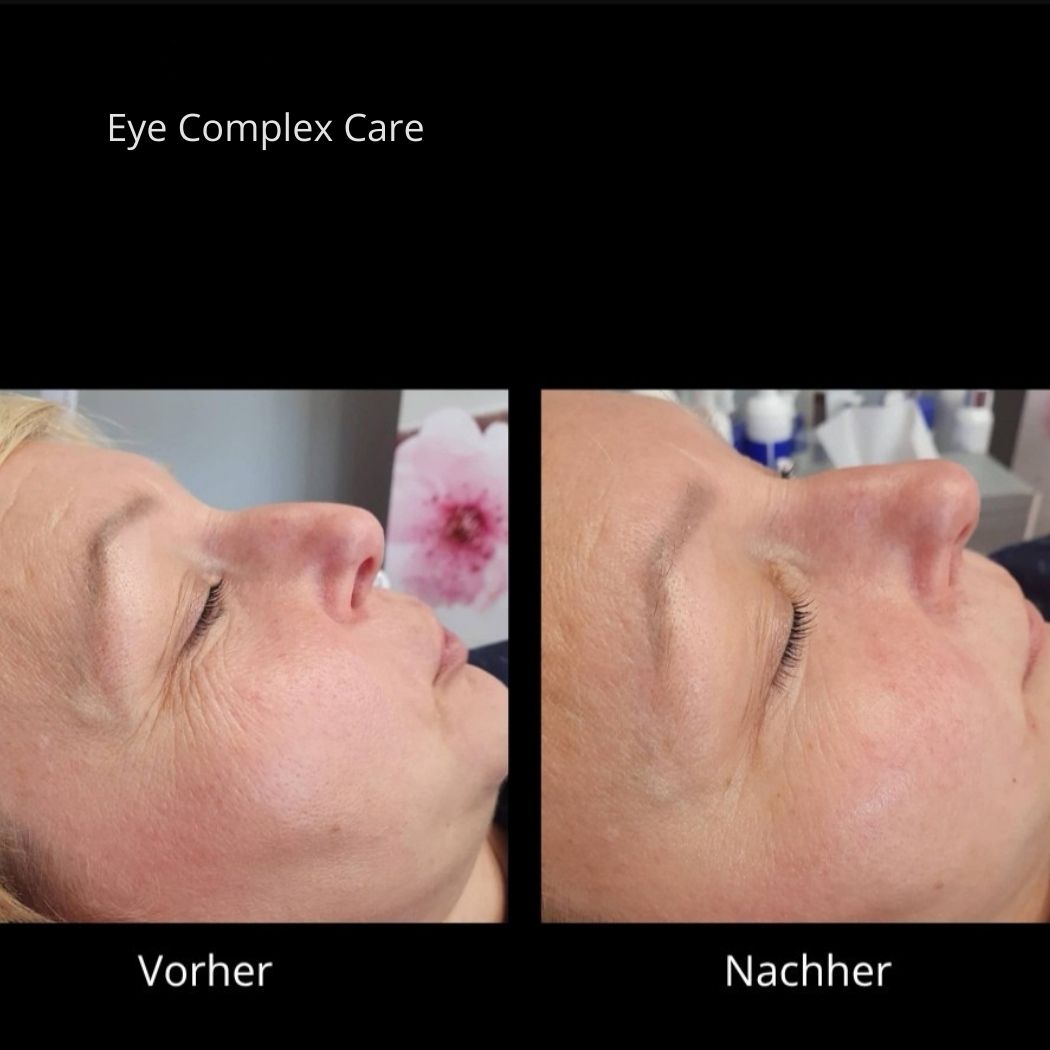 Eye Complex Care