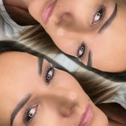 Mirella Beauty PLASMA PEN Berlin